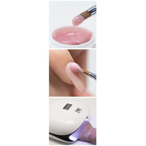 Trial Synergy Gel Kit